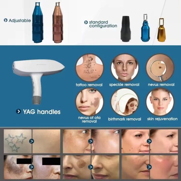 **NEWEST MODEL**Voyager 4 Pro IPL/SHR/Yag (SUE)) - Image 8