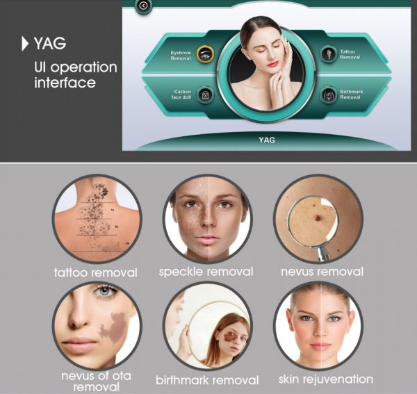 Ranger 2 -  Diode/YAG Laser - Image 7