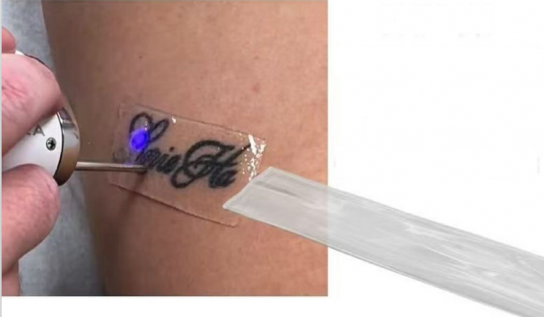 Safe Silicone Tattoo Removal patch - Image 2